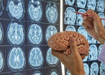 IA enfermedades neurodegenerativas psiquiátricas