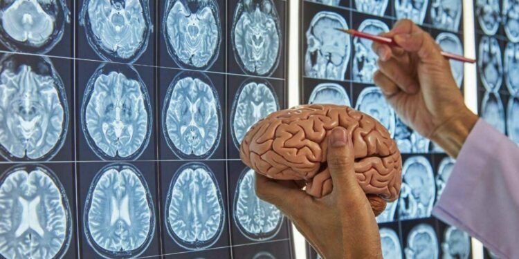 IA enfermedades neurodegenerativas psiquiátricas