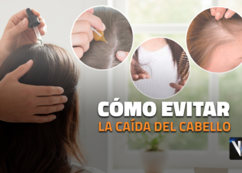 prevenir caída cabello