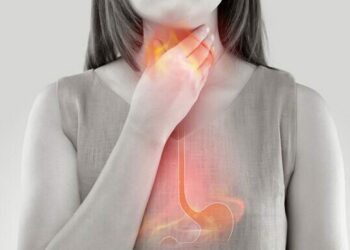 hábitos alimenticios reflujo alimentación